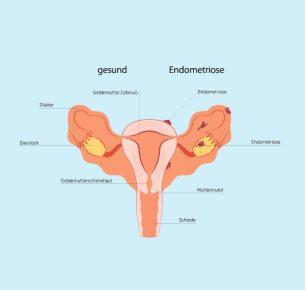 Grafik: VectorMine | iStockphoto.com