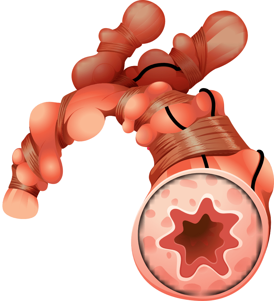 Grafik: blueringmedia | iStockphoto.com