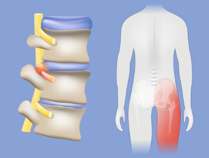 Grafik: ttszi/iStockphoto.com