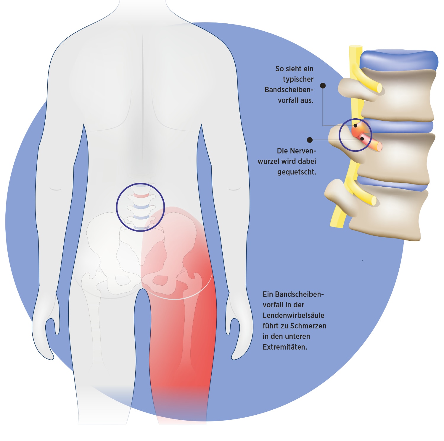 Grafik: ttszi/iStockphoto.com