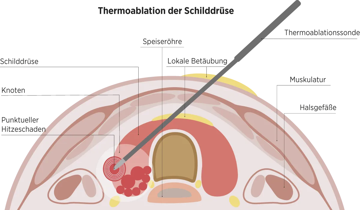 Grafik: MADSACK Medienagentur