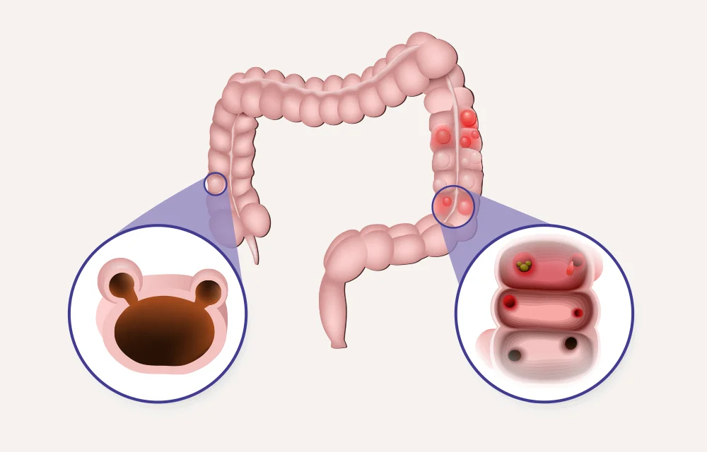 Grafik: ttsz | iStockphoto.com