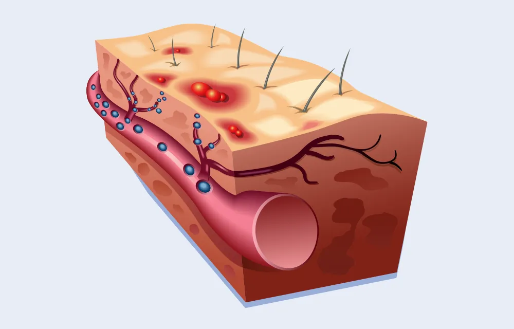 Grafik: rob3000 | stock.adobe.com