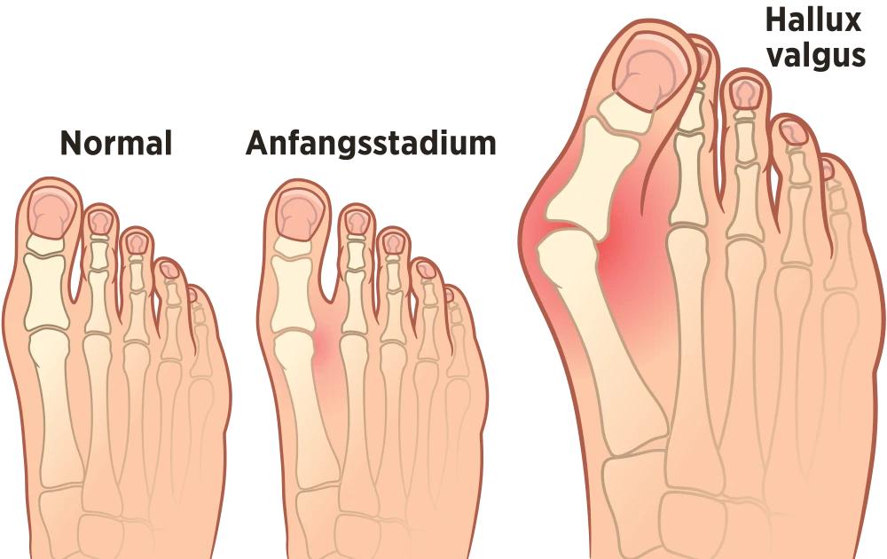 Grafik: Refluo | iStockphoto.com Grafik: Refluo | iStockphoto.com